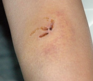 1380945256-1007750869