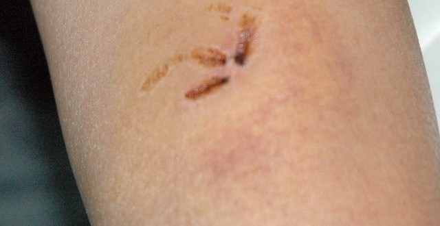 1380945256-1007750869