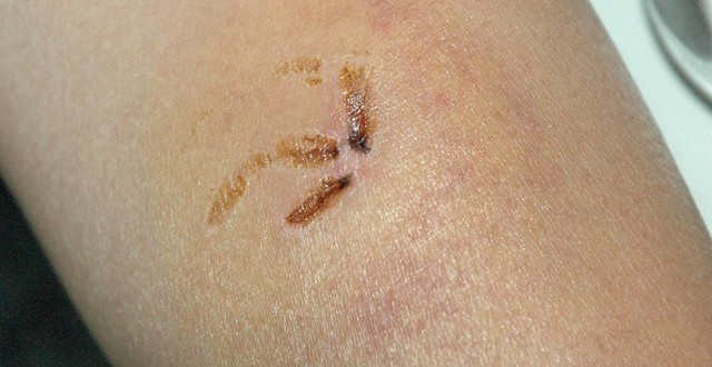 1380945256-1451801717